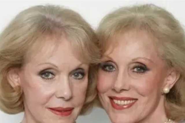 انتحار اشهر التوأمتين في أوروبا بقرار “موت مُساعد”