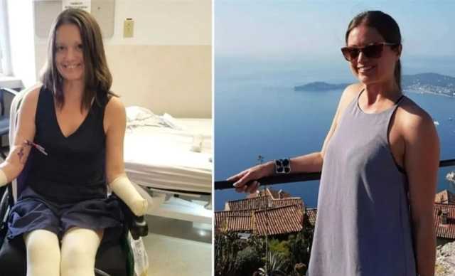 بتر قدمين ويدين فتاة بسبب آلام حلق !!