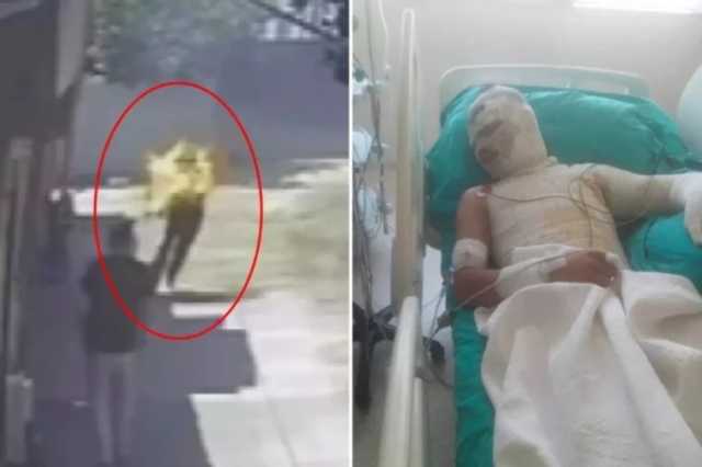 شاب يحترق على يد عمه إثر نزاع عائلي