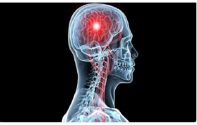استشاري: المشاعر السلبية تؤدي إلى زيادة معدل تلف الخلايا الدماغية