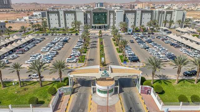 إجراء عملية بالمنظار لسيدة تعاني من ثقب كبير في غشاء الطبلة بالجوف