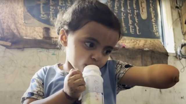 قصف وحشي يخطف أحد جناحيها.. من يعيد ذراع الطفلة تالا في غزة؟ (شاهد)