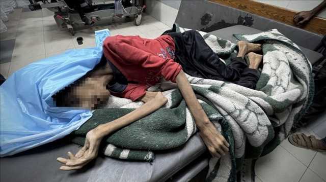 نداء إنساني عاجل: أطفال غزة يموتون جوعًا والمجتمع الدولي مطالب بإنقاذهم فورًا