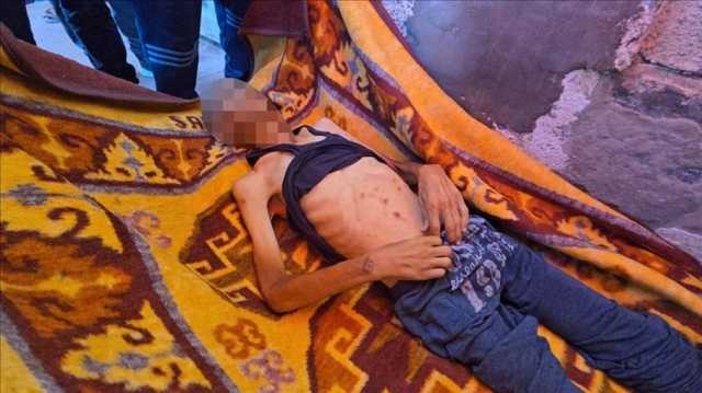 عالم شرعي يمني: تجويع غزة جريمة شرعية تستوجب القصاص