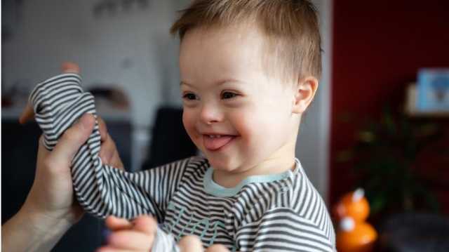 خطوة نحو علاج متلازمة داون.. باحثون ينجحون في إزالة الكروموسوم الـزائد