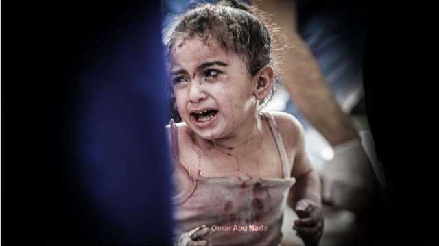 عدد القتلى الأطفال بغزة في أقل من شهر 10 أضعاف نظرائهم الأوكرانيين في عام