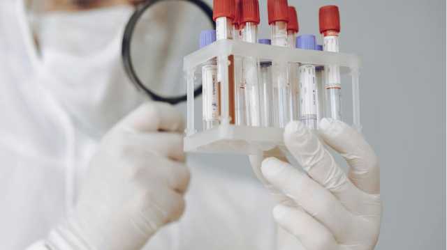 متبرع بالحيوانات المنوية يحمل جينا سرطانيا أُنجب 200 طفل في أوروبا