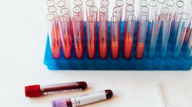 علاج جيني للّوكيميا يمنح المرضى أملا في الشفاء