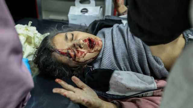 أجساد مقطعة.. شهادات مفزعة لأطباء أمريكيين كانوا في غزة