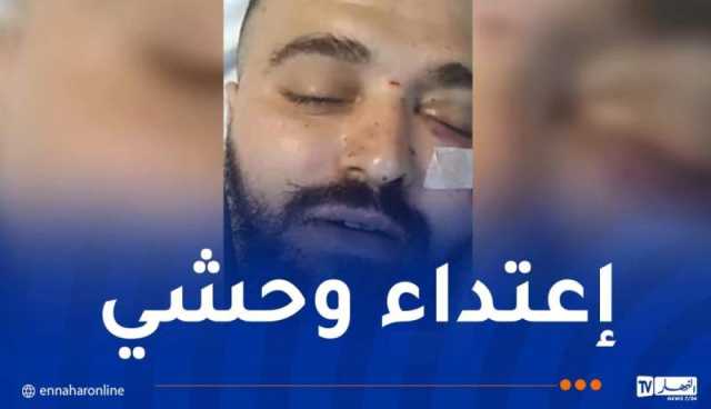 اعتداء عنيف من أحد موظفي شركة كورسيكا على مسافر جزائري 