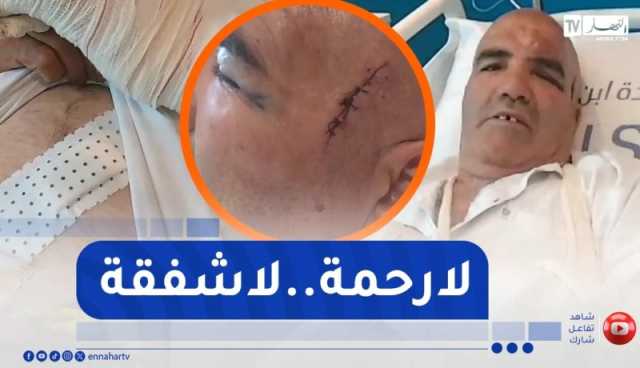 شاهد..حالة “عمي موسى” المواطن الذي تعرض للسرقة و الضرب بعين فكرون