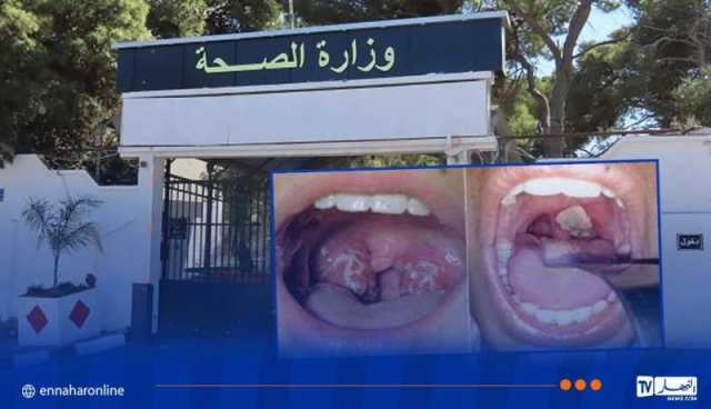 سكيكدة.. وفاة شخصين وتسجيل 5 حالات مؤكدة بداء الدفتيريا