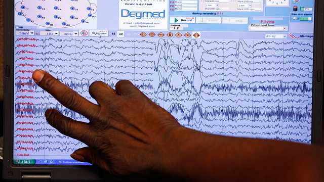 دراسة تكشف رابطًا غير متوقع بين فقدان الوزن في منتصف العمر وصحة الدماغ