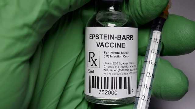 الفيروس الشائع المسبب لداء كثرة الوحيدات محفز محتمل لمرض الذئبة الحمراء