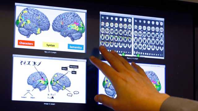 بين الحمل وسن اليأس... لماذا ترتفع مخاطر السكتة الدماغية لدى النساء؟