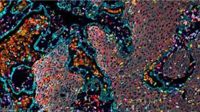 اكتشاف طبي جديد.. تجارب تُظهر إمكانية دفع الخلايا السرطانية إلى الموت الذاتي