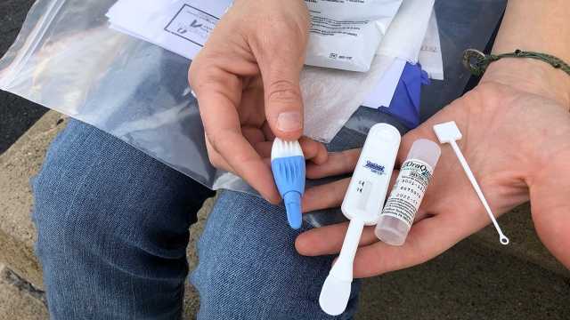 السلطات الصحية: أوروبا لا ترصد بما يكفي فيروس نقص المناعة البشرية والتهاب الكبد