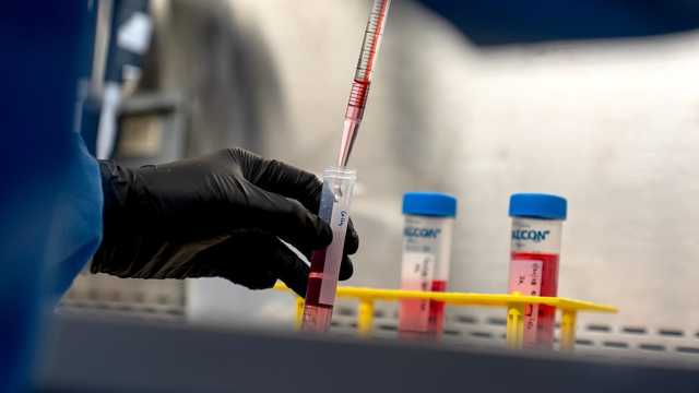 باحثون يكتشفون طريقة لإعادة تنشيط المناعة وتقوية قدرة الجسم على القضاء على الأورام