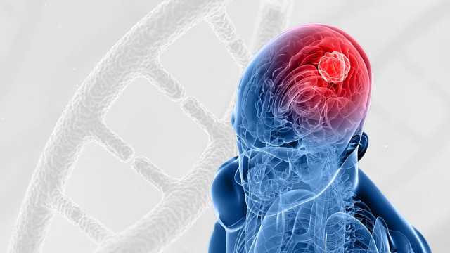 اختراق علمي: تطوير علاج جديد يُظهر فعالية واعدة ضد أخطر أورام الدماغ