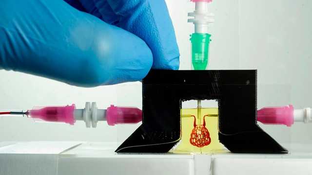 تقنية جديدة لطباعة أوعية دموية على الزجاج تفتح آفاقًا للتنبؤ بالسكتة الدماغية