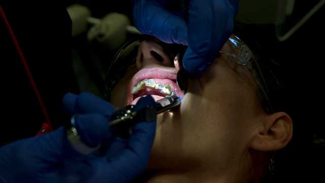 صحة فمك قد تحمي دماغك.. دراسة تربط أمراض اللثة والتسوس بزيادة خطر السكتة الدماغية