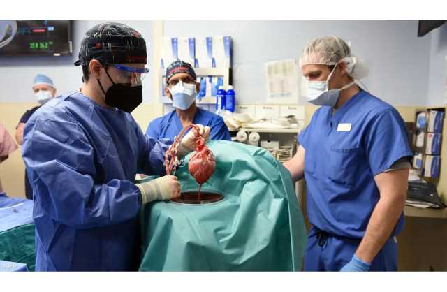 بأقل من عامين.. زرع قلب خنزير في جسم إنسان للمرة الثانية