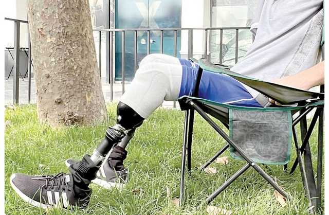 تطوير أطراف إلكترونية تنفّذ الوظائف مثل الأطراف البشرية