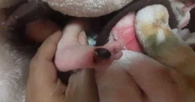 العثور على طفلة حديثة الولادة فى القمامة بالشرقية