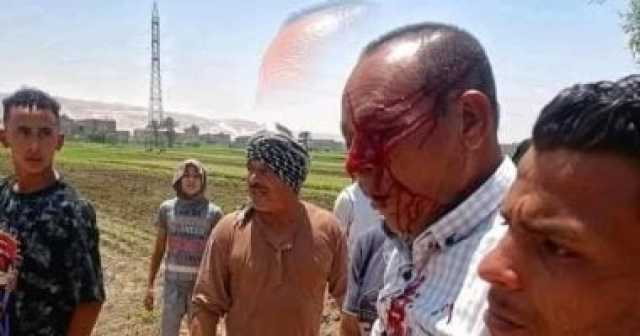 التقرير الطبى للموظف المعتدى عليه بسوهاج: انفجار مفرغ فى مقلة العين اليسرى