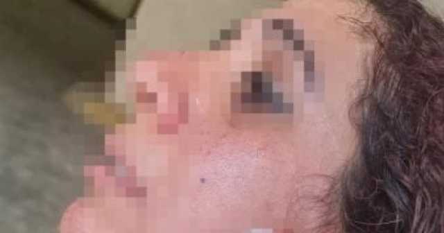 التحقيق فى واقعة تعدى زوج على زوجته بسبب قضية خلع بمحكمة الدخيلة بالإسكندرية