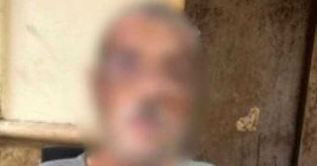 بسبب البضائع أمام الورشة.. خلاف يتحول إلى حريق بالأجساد فى الجمالية