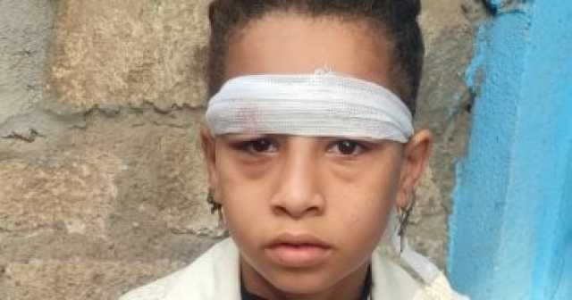 إصابة تلميذة بـطوبة داخل مدرسة ابتدائية بقنا