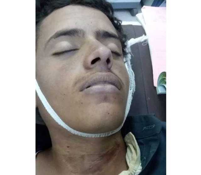انتحار شاب شنقاً في عمران بعد عودته من دورة طائفية مغلقة