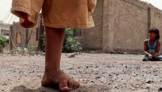 مقتل طفل أثناء عبثه بعبوة ناسفة حوثية في صرواح غربي مأرب