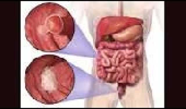 الطفح الجلدي والغدة الدرقية – الكشف عن تفاصيل لم تكن تعرفها
