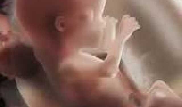 القولون العصبي وخفقان القلب.. علاقة خفية تثير قلق المرضى