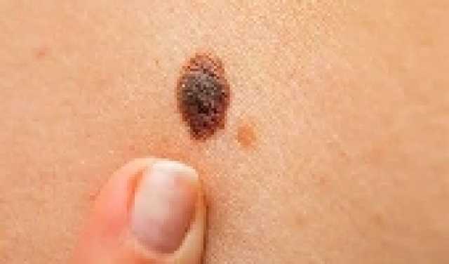 ثورة طبية وتقنية: ابتكار أصغر وأسرع واجهة دماغ–حاسوب في العالم