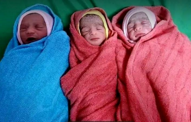 أم يمنية تتفاجأ بإنجاب ثلاثة توائم
