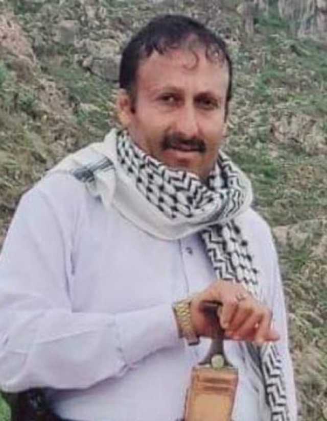 عصابة مسلحة تقتحم عيادة طبيب شمال العاصمة صنعاء وتنهبها وتطلق النار على أخته (تفاصيل)