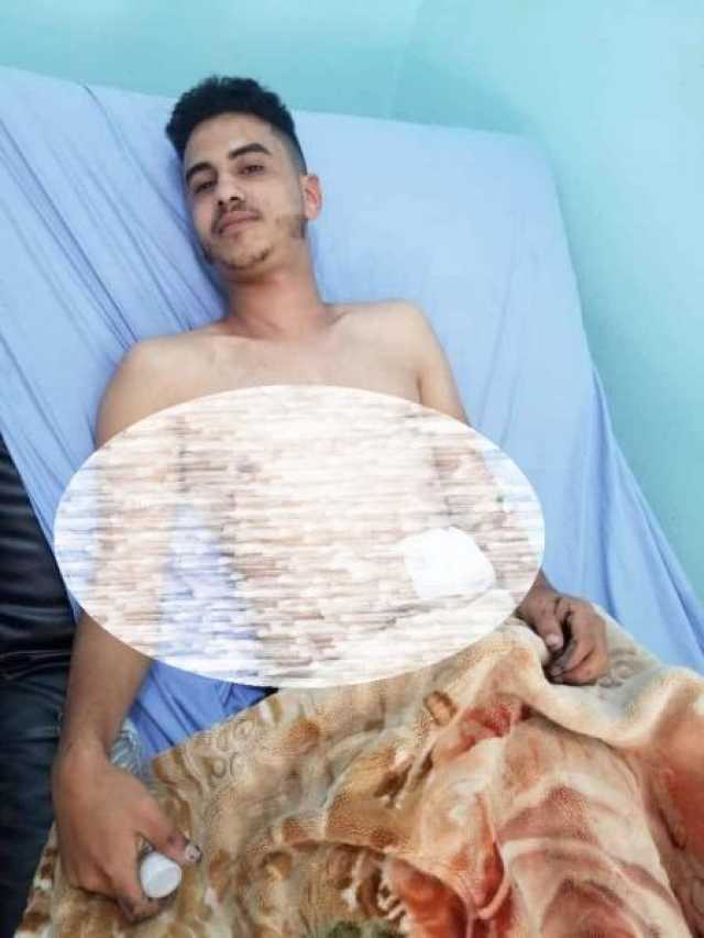 عصابة مسلحة في إب تسطو على محل لبيع الهواتف وتنهب ما بداخله وإصابة مالكه خلال محاولته التصدي لها