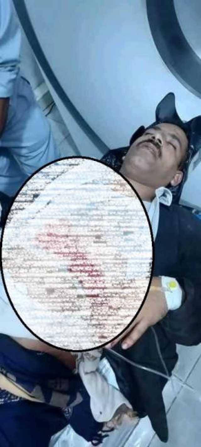 العثور على جثة شاب مرمية على قارعة الطريق بعد استلامه حوالة مالية جنوب غربي اليمن