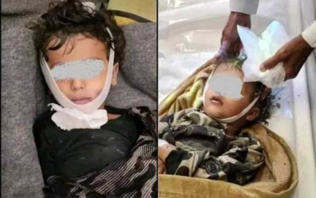مأساة في حجة.. وفاة طفلين شقيقين غرقًا في خزان مياه