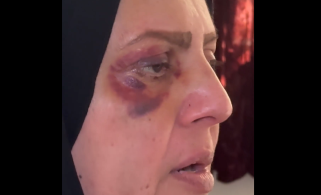ضربت نفسها.. شرطة الرصافة تنفي تعرض امرأة للتعذيب