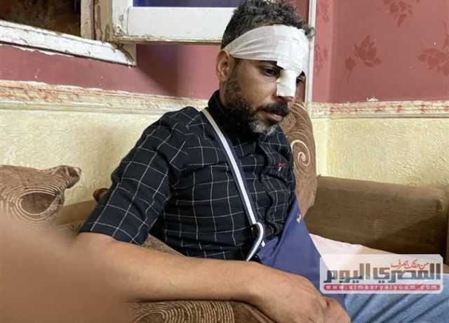 شروع في قتل «عامل» داخل جراج لإبلاغه عن سرقة «فتيس» (فيديو)