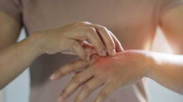 'طفيليات مجهرية' تهدد الولايات المتحدة الأمريكية