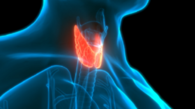طبيب: الأشعة السينية تزيد خطر الإصابة بسرطان الغدة الدرقية