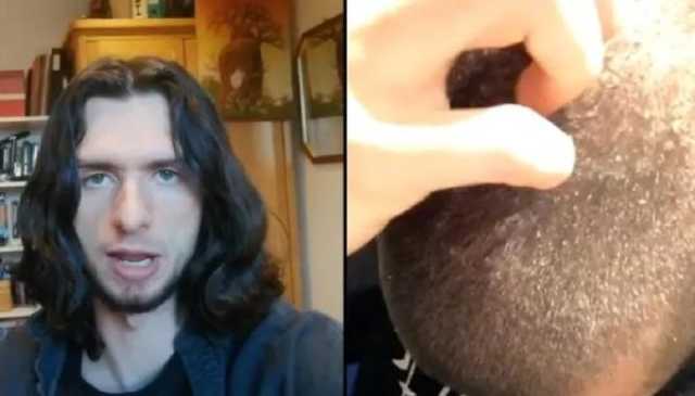 رجل يكشف عن نتائج تجربته بعد أن توقف عن استخدام الشامبو لمدة 7 سنوات