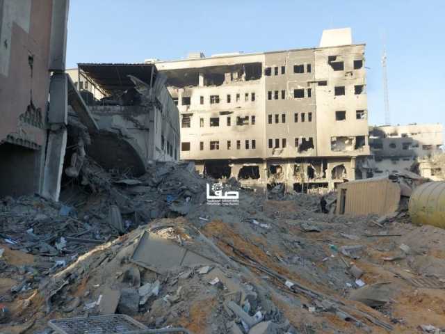 مجمع الشفاء الطبي يصدر تنويهًا بخصوص رفات الشهداء المدفونين في حرمه
