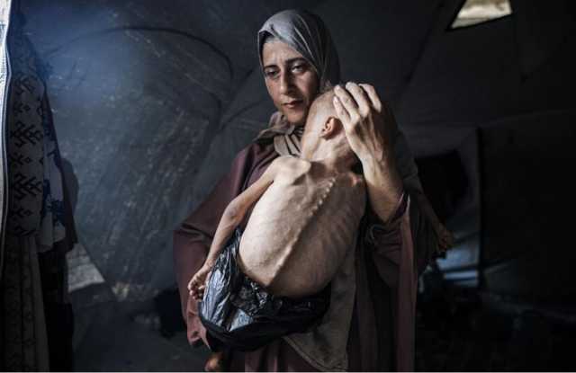 'أوكسفام': الأمراض بغزة قد تتحول إلى كارثة قاتلة