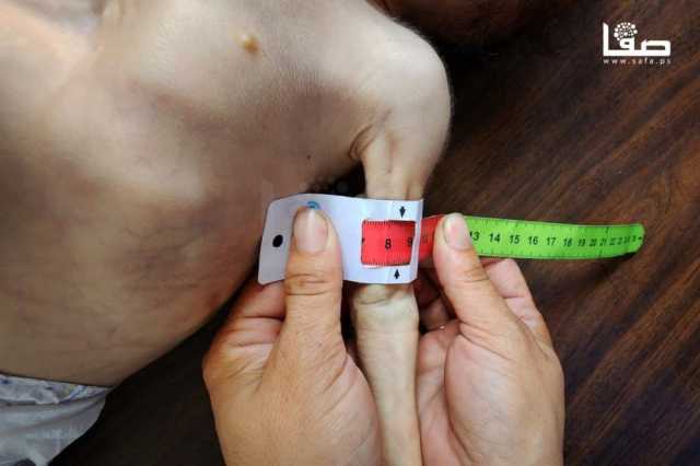لوقف 'أسوأ سيناريو للمجاعة'.. أونروا تدعو إلى إغراق غزة بالمساعدات